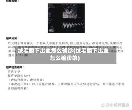 绒毛膜下出血怎么确诊(绒毛膜下出血怎么确诊的)-第3张图片