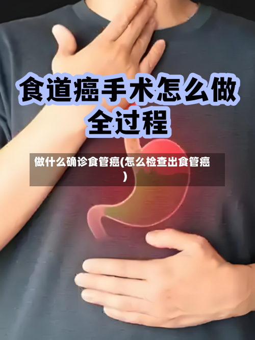 做什么确诊食管癌(怎么检查出食管癌)-第2张图片