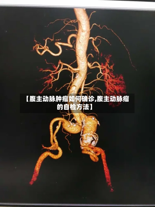 【腹主动脉肿瘤如何确诊,腹主动脉瘤的自检方法】